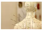 Acupuncture Toronto: Safe & Natural Way for Pain Relief