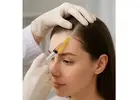 PRP Hair Treatment in Islamabad