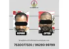 Best hair transplant clinics near me