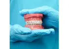 Straighten Your Teeth with Braces Treatment in