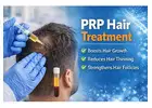 PRP Hair Treatment at Apolo Hair Studio | Best Hair Transplant in Noida