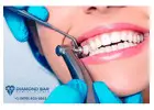 Top Dentist in Diamond Bar for Implants & Teeth Cleaning Care