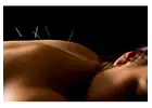 Pain Management Acupuncture in NYC | Back, Neck & Sciatica Relief