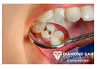 Fast Emergency Dentist Diamond Bar | Same Day Dental Appointments