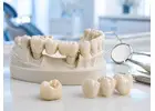 Durable Dental Crowns and Bridges for Missing or Damaged Teeth