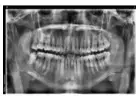 Get Your Perfect Smile by Treating from Dentist in Tijuana