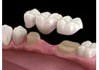 Trusted Dentist in Abbotsford | Your Local Dentist Near Me
