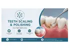 Teeth Scaling and Polishing in Islamabad