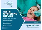 Professional Teeth Whitening Service for a Brighter Smile