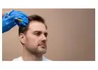 Advanced GFC Hair Treatment for Stronger Hair Dermaprocenter