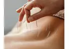 Pain Management Acupuncture in NYC | Back, Neck & Sciatica Relief